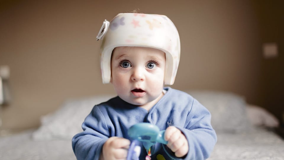 Treating Torticollis