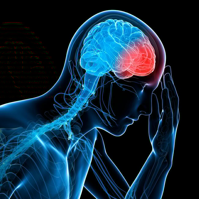 Orthopedic Core Curriculum - Concussion