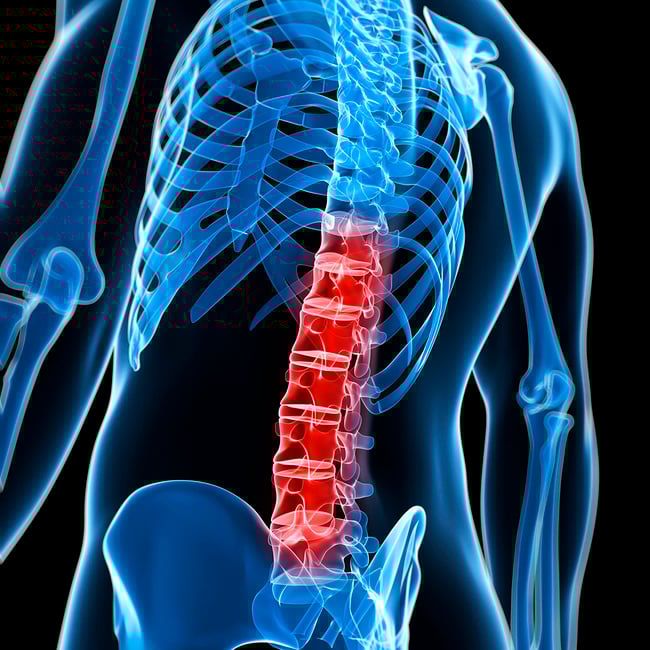 Orthopedic Core Curriculum - Lumbar Spine