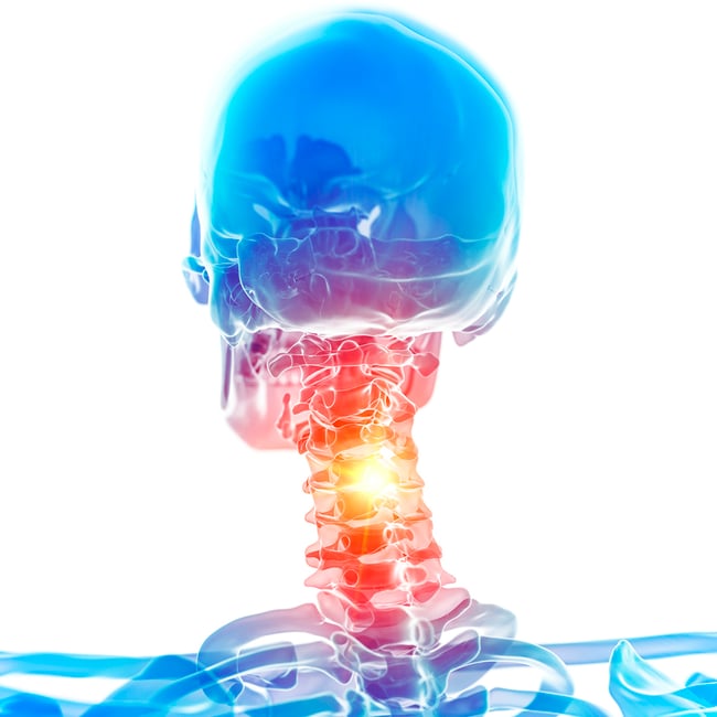 Orthopedic Core Curriculum - Cervical and Thoracic Spine