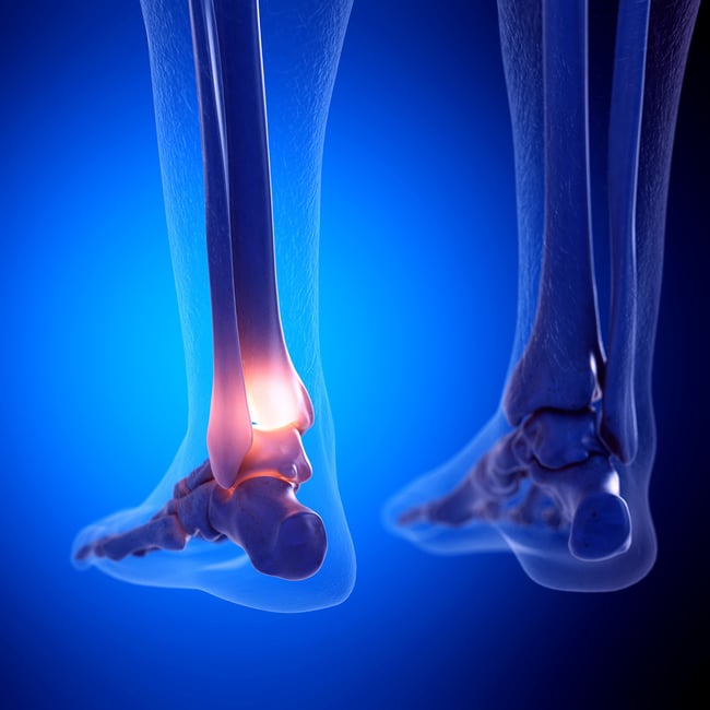 Orthopedic Core Curriculum - Foot and Ankle