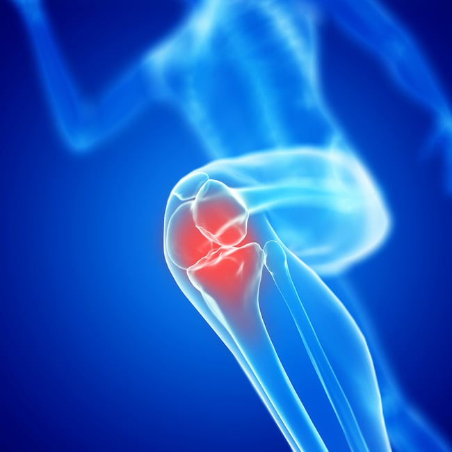 Orthopedic Core Curriculum - Knee