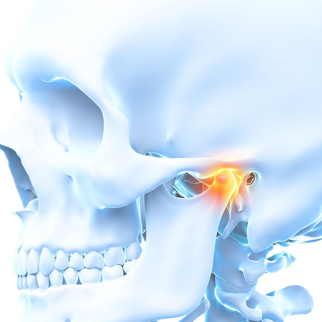 Orthopedic Core Curriculum - Temporomandibular Joint