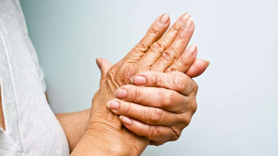 Arthritis, Osteoporosis, and Osteopenia